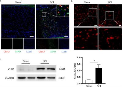 Neutrophil Extracellular Traps Exacerbate Secondary Injury via Promoting Neuroinflammation and Blood–Spinal Cord Barrier Disruption in Spinal Cord Injury